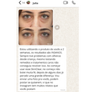 SkinClear - Retire Imperfeições Faciais  |COMPRE 1 LEVE 2| Frete Grátis