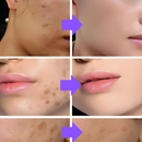 Máscara de Colágeno Verisol - Adeus Imperfeições Faciais | 1 UNIDADE | Frete Grátis