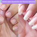 COMPRE 2 LEVE 3 | Caneta de Crescimento de Unhas com Células-Tronco | Frete Grátis
