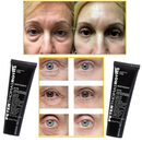 SkinClear - Retire Imperfeições Faciais  |COMPRE 1 LEVE 2| Frete Grátis