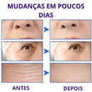 Máscara de Colágeno Verisol - Adeus Imperfeições Faciais | 1 UNIDADE | Frete Grátis