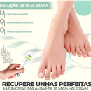 Efero Nails - Removedor de Fungos/Micoses + Fortalecimento das Unhas |COMPRE 2 LEVE 3| Frete Grátis