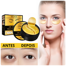 Golden Circles - O FIM DAS OLHEIRAS | COMPRE 1 LEVE 2  | Frete Grátis