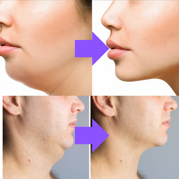 LiftNeck - Revitalize sua Pele | 1 UNIDADE