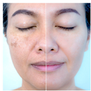 Máscara de Colágeno Verisol - Adeus Imperfeições Faciais | 1 UNIDADE | Frete Grátis