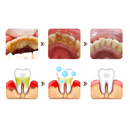 PastaClean - Remova TODAS Imperfeições Bucais | COMPRE 1 LEVE 2 + Frete GRÁTIS