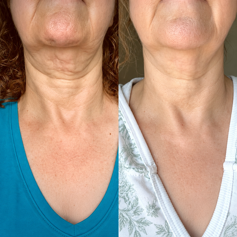 Resultado de cliente