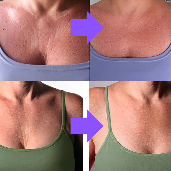 LiftNeck - Revitalize sua Pele | 1 UNIDADE