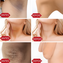 Clareador de Manchas na Pele - HarmoniaRosa I COMPRE 1 LEVE 2 I + Frete Grátis