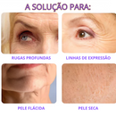 KIT 10 UNIDADES Máscaras CollagenBoost - ATIVOS DO BOTOX | Frete Grátis