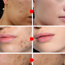 Sérum Celestial: Ação Clareadora e Antirrugas - Retire Imperfeições Faciais | COMPRE 1 LEVE 2 | Frete Grátis