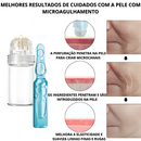 KIT RENEW 7 AMPOLAS + 1 APLICADOR DE BRINDE -  Retire IMPERFEIÇÕES *EFEITO BOTOX* | Frete Grátis