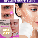 KIT 10 UNIDADES Máscaras CollagenBoost - ATIVOS DO BOTOX | Frete Grátis