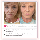 Golden Circles - O FIM DAS OLHEIRAS | COMPRE 1 LEVE 2  | Frete Grátis