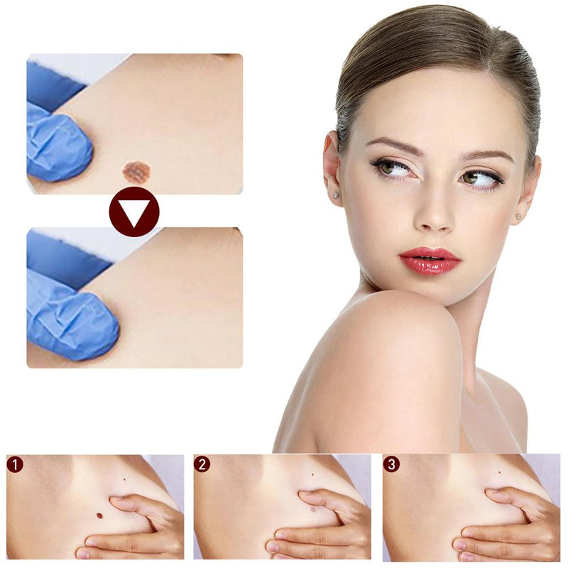 VerruDerma -  Removedor de Verrugas e Sinais Rápido e Eficiente