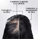 HairUp - Diminui Queda em 95%