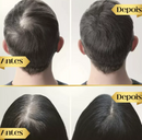 HairUp - Diminui Queda em 95%